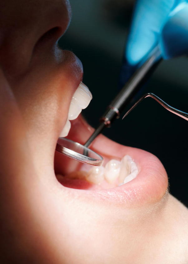 Diagnostics,Gum Disease Treatment,Dental Implants,Perioplastic Surgery,Oral Medicine,Teeth Cleaning,Conscious Sedation,Periodontist,Periodontist Dental Implant Specialist